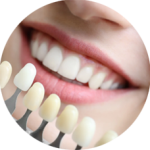 Blanchiment des dents