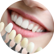 BBlanchiment des dents